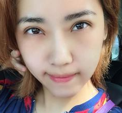 超声波双眼皮让我心灵的鸡汤终于打开啦922 超声波双眼皮让我心灵的鸡汤终于打开啦922