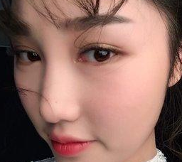 超 声 波双眼 皮让天然女更天然le 超 声 波双眼 皮让天然女更天然le