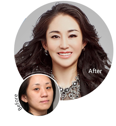 想要轻松去眼袋就到超雅来做超声波去眼袋247 想要轻松去眼袋就到超雅来做超声波去眼袋247