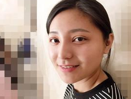 天真无辜芭比眼来啦,超 声 波双眼 皮塑形得哦 天真无辜芭比眼来啦,超 声 波双眼 皮塑形得哦