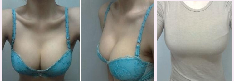 超 声 波丰胸技术-满足所有女性得大胸梦 超 声 波丰胸技术-满足所有女性得大胸梦