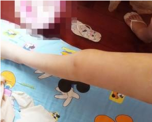 遗传梨型身材只有超 声 波减肥能解救啦 遗传梨型身材只有超 声 波减肥能解救啦
