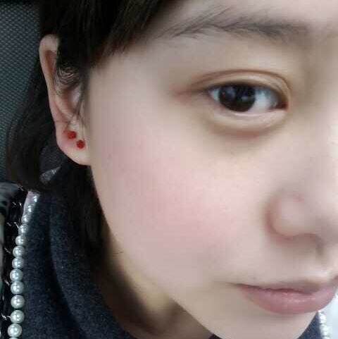 超 声 波双眼 皮为什么如此受欢迎? 超 声 波双眼 皮为什么如此受欢迎?