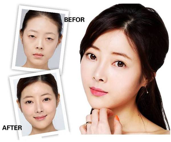 超 声 波双眼 皮为什么如此受欢迎? 超 声 波双眼 皮为什么如此受欢迎?