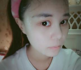 超 声 波双眼 皮后让wǒ自动省去美眼妆容，好看啊