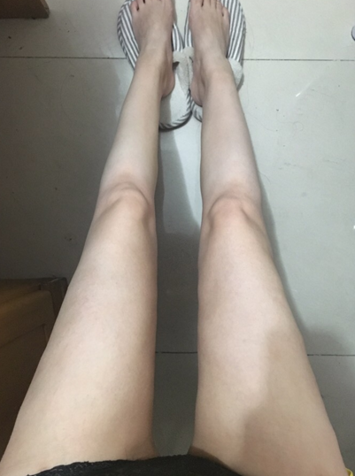 超声波减肥后终于可以穿S码的裤子了!225 超声波减肥后终于可以穿S码的裤子了!225