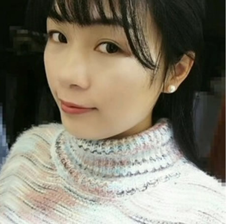 和闺蜜组团做超声波祛眼袋，毕竟女人只有自己最爱自己了045