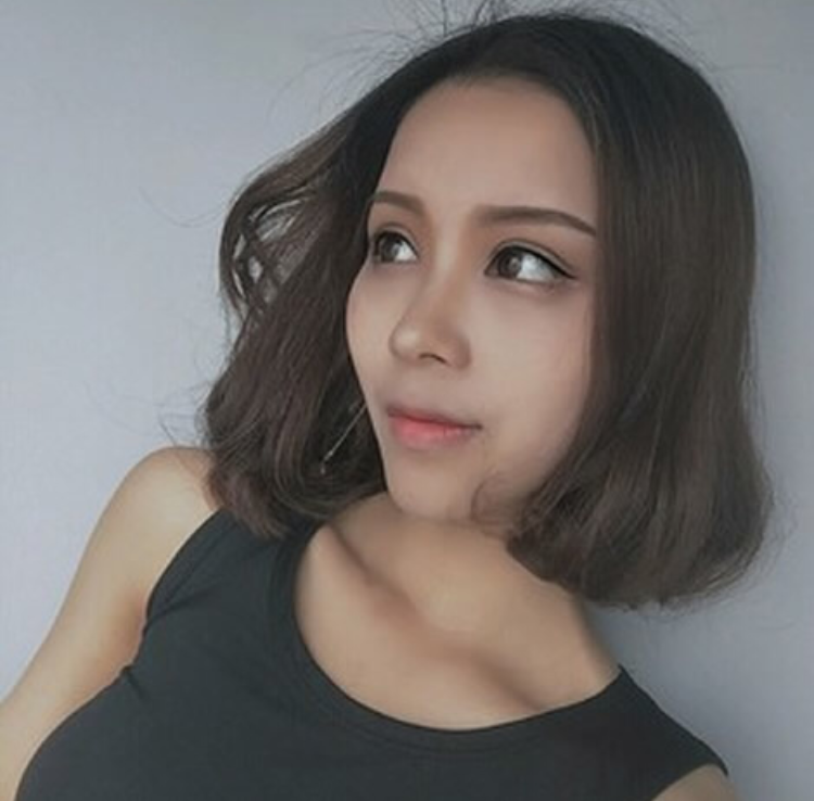 姐姐和妹妹都相当满意超 声 波双眼 皮 姐姐和妹妹都相当满意超 声 波双眼 皮
