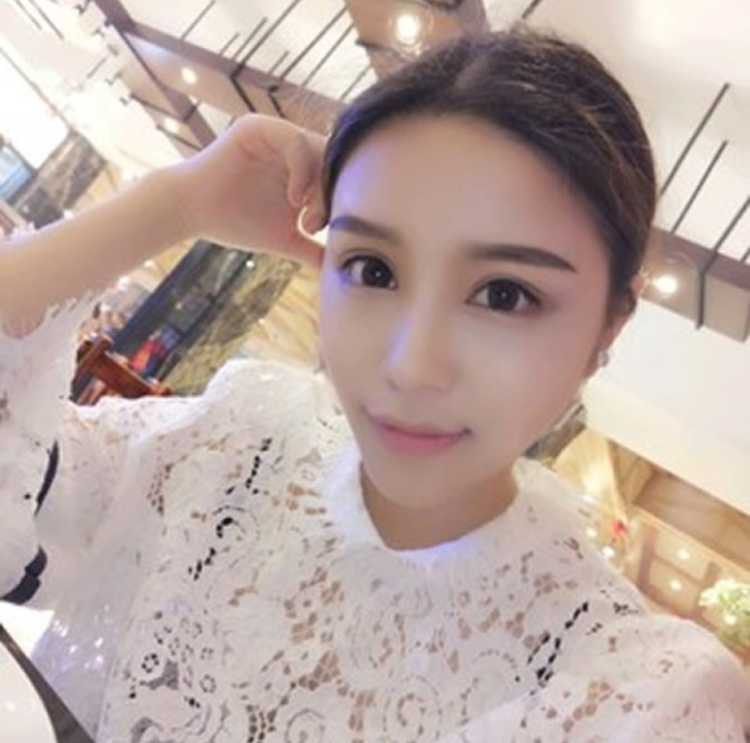 姐姐和妹妹都相当满意超 声 波双眼 皮 姐姐和妹妹都相当满意超 声 波双眼 皮