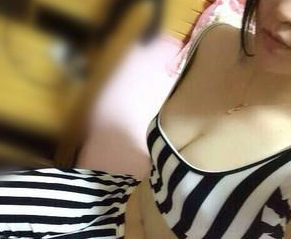 超声波自体脂肪丰胸后我也可以婀娜多姿、凹凸有致！012