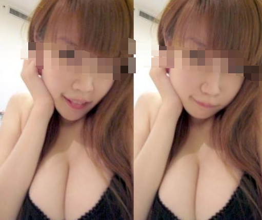 做了鼻子后我又来做超声波自体脂肪丰胸了890 做了鼻子后我又来做超声波自体脂肪丰胸了890