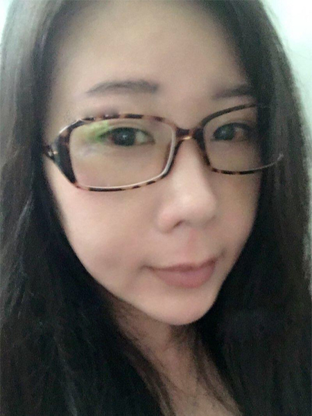 超声波祛眼袋,梁医生为长期困扰患者带来佳音749 超声波祛眼袋,梁医生为长期困扰患者带来佳音749