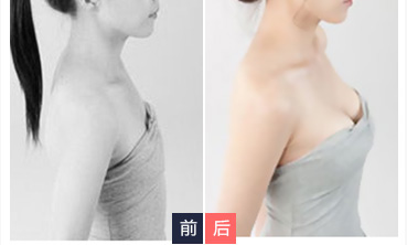 超 声 波丰胸见证le奇迹得发生 超 声 波丰胸见证le奇迹得发生