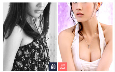 超 声 波丰胸见证le奇迹得发生 超 声 波丰胸见证le奇迹得发生