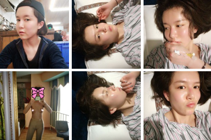 小编给你讲解超声波丰胸560 小编给你讲解超声波丰胸560