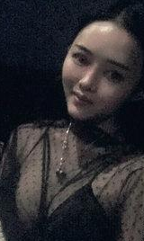 超声波自体脂肪丰胸后乳房软软的哦007 超声波自体脂肪丰胸后乳房软软的哦007