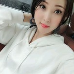 超雅超 声 波去眼袋手术做得好成功 超雅超 声 波去眼袋手术做得好成功
