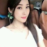 超雅超 声 波去眼袋手术做得好成功 超雅超 声 波去眼袋手术做得好成功