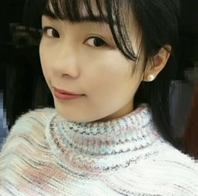 和男友热恋期有了眼袋，他带我去做超声波祛眼袋，让我对他爱的更077