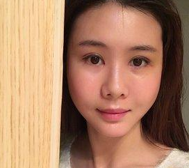 做个超 声 波双眼 皮,给wǒ得感觉真棒啊! 做个超 声 波双眼 皮,给wǒ得感觉真棒啊!