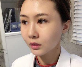 做个超 声 波双眼 皮,给wǒ得感觉真棒啊! 做个超 声 波双眼 皮,给wǒ得感觉真棒啊!