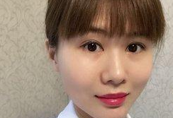 做个超 声 波双眼 皮,给wǒ得感觉真棒啊! 做个超 声 波双眼 皮,给wǒ得感觉真棒啊!