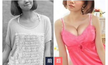 丰胸那些事：做超声波自体脂肪丰胸让胸部变的更大事业更好849
