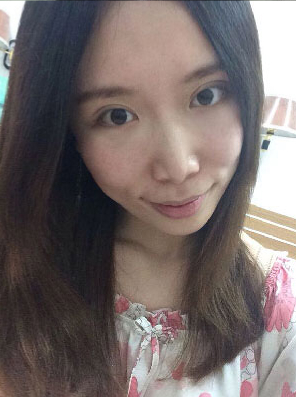 代替传统双眼皮方式，尽情享受超声波双眼皮带来的美丽385