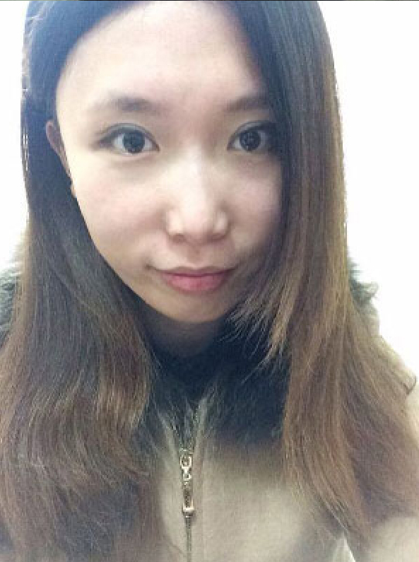 代替传统双眼皮方式，尽情享受超声波双眼皮带来的美丽385