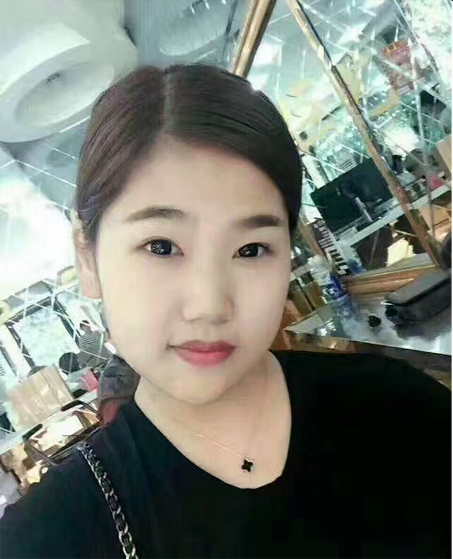 超声法减肥教抽脂减肥优势更明显339 超声法减肥教抽脂减肥优势更明显339
