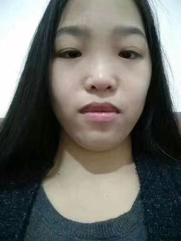 超声法减肥教抽脂减肥优势更明显339 超声法减肥教抽脂减肥优势更明显339