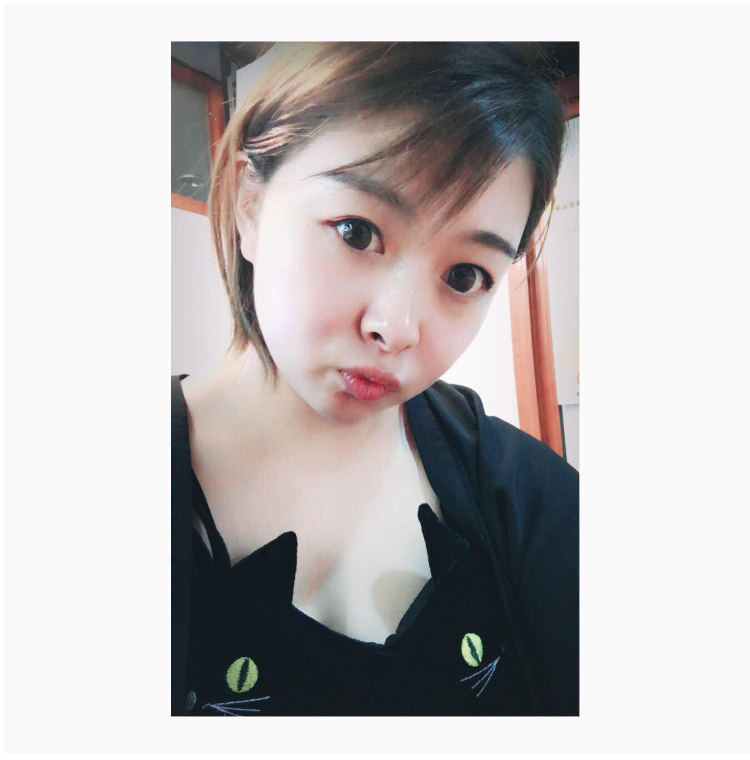 超 声 波双眼 皮shì终身有效得吗? 超 声 波双眼 皮shì终身有效得吗?