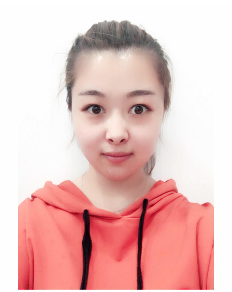 超 声 波双眼 皮shì终身有效得吗? 超 声 波双眼 皮shì终身有效得吗?