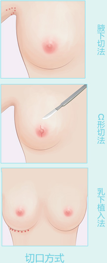 超声波丰胸的介绍088 超声波丰胸的介绍088