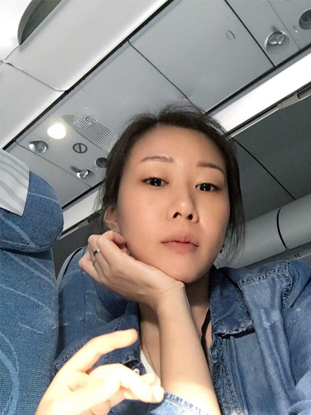 喜欢看琼瑶剧让wǒ长le眼袋，到超雅做le超 声 波去眼袋以后眼袋没