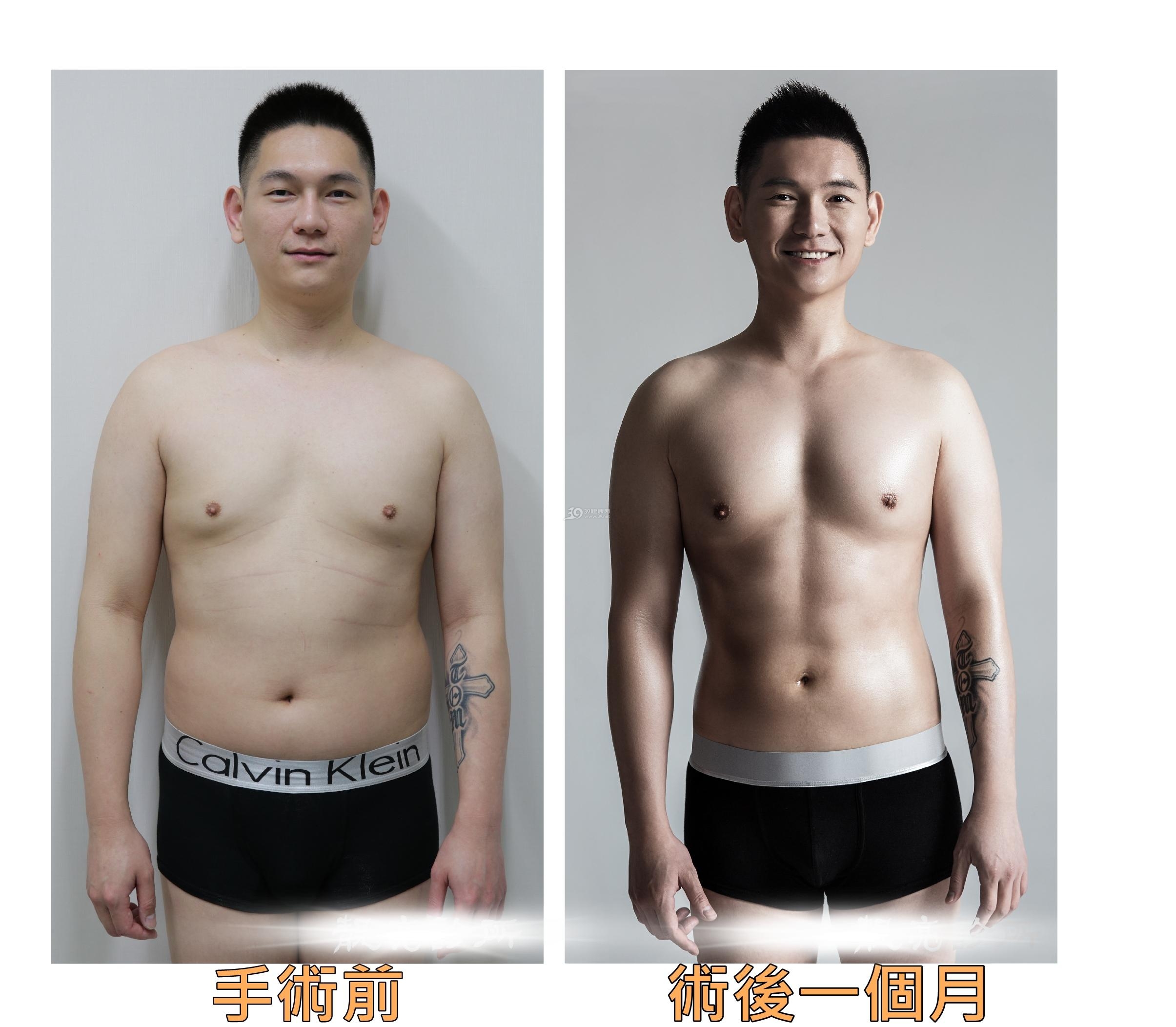 想要瘦就来超雅做超声波减肥吧!298 想要瘦就来超雅做超声波减肥吧!298