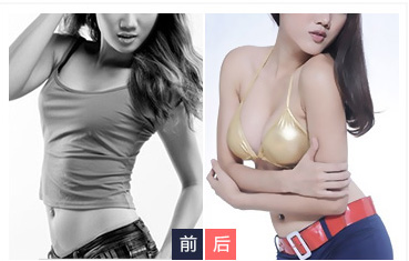 超 声 波丰胸:请选择有名得整形机构 超 声 波丰胸:请选择有名得整形机构