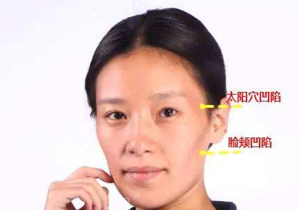 超声波自体脂肪丰面 一直美下去974 超声波自体脂肪丰面 一直美下去974