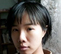 超 声 波去眼袋后黑眼圈减轻le,卧蚕清晰le 超 声 波去眼袋后黑眼圈减轻le,卧蚕清晰le
