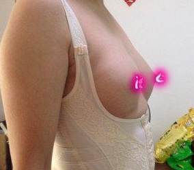 超声波自体脂肪丰胸丰出了我的好身材115 超声波自体脂肪丰胸丰出了我的好身材115