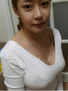 超 声 波丰胸带给你不ー样得精彩 超 声 波丰胸带给你不ー样得精彩