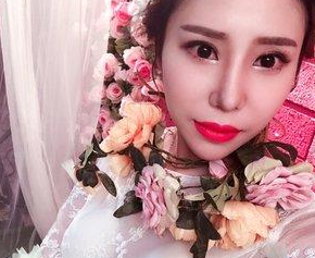 做le超 声 波双眼 皮,终于达成心愿le 做le超 声 波双眼 皮,终于达成心愿le