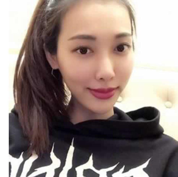 超 声 波去眼袋让wǒ不再做灭绝师太le 超 声 波去眼袋让wǒ不再做灭绝师太le