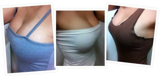 超声波自体脂肪丰胸是自然丰乳的方法516 超声波自体脂肪丰胸是自然丰乳的方法516