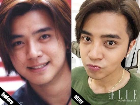 为什么要做双眼皮-470 为什么要做双眼皮-470
