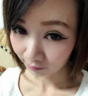 重庆超雅超 声 波去眼袋案例:眼袋没有le 重庆超雅超 声 波去眼袋案例:眼袋没有le