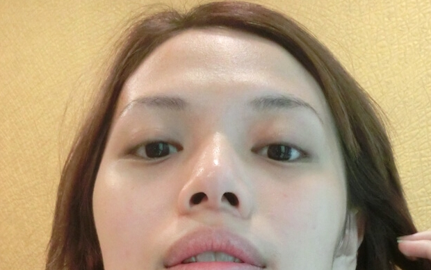 做le不开刀隆鼻变成拍照狂魔 做le不开刀隆鼻变成拍照狂魔