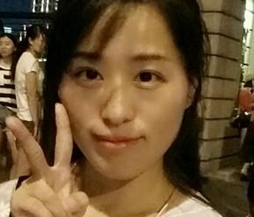 超 声 波去眼袋,效果不错,卧蚕很清晰 超 声 波去眼袋,效果不错,卧蚕很清晰