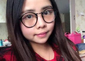 超声波去眼袋术后恢复分享,真人案例哦221 超声波去眼袋术后恢复分享,真人案例哦221