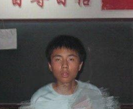 男生也做超声波双眼皮啦,真人案例900 男生也做超声波双眼皮啦,真人案例900